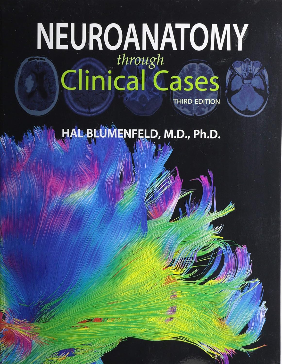 Neuroanatomy through Clinical Cases 3rd Edition pdf