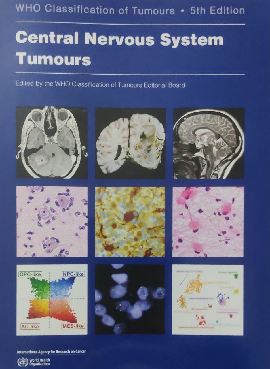 who classification of tumor central nervous system tumors 5th edition pdf